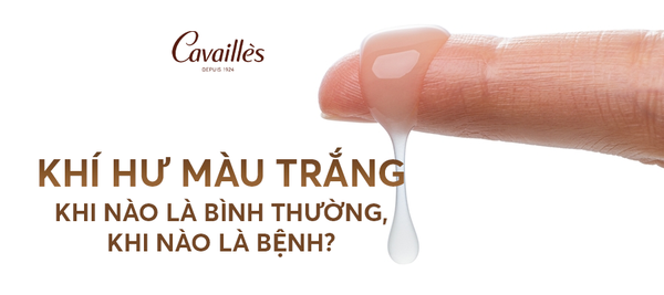 Khí hư màu trắng – khi nào là bình thường, khi nào là bệnh?