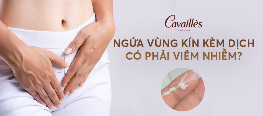 Ngứa vùng kín kèm dịch – có phải viêm nhiễm?