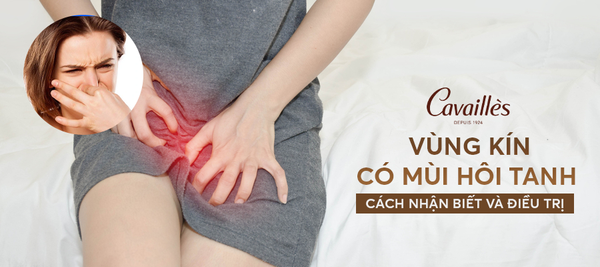 Vùng kín có mùi hôi tanh: Cách nhận biết và điều trị