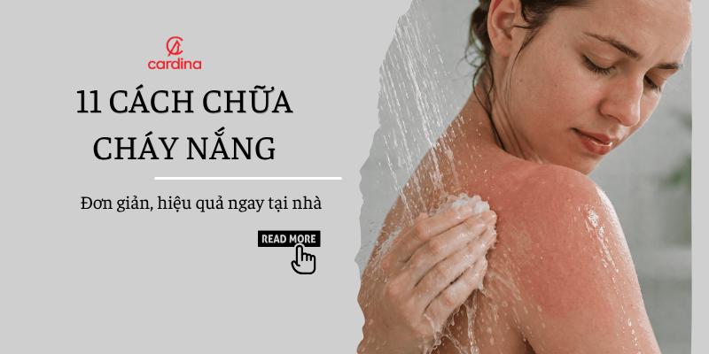 11 cách chữa cháy nắng đơn giản, hiệu quả ngay tại nhà