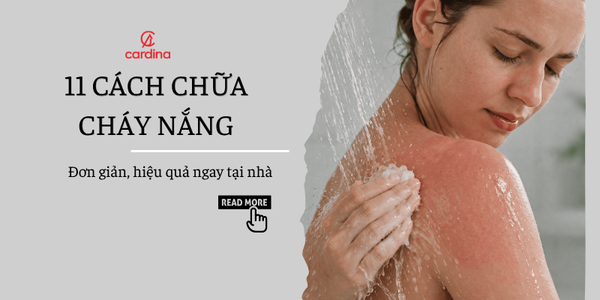 11 cách chữa cháy nắng đơn giản, hiệu quả ngay tại nhà