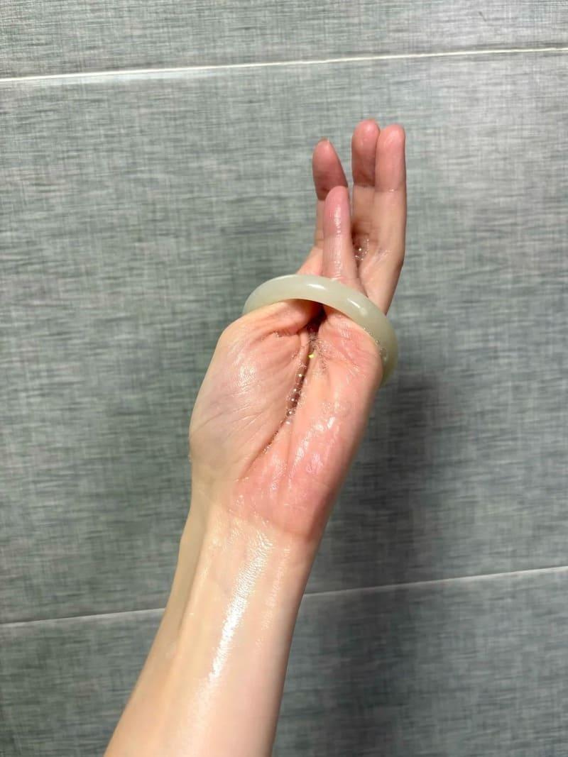ách đeo vòng tay bị chật