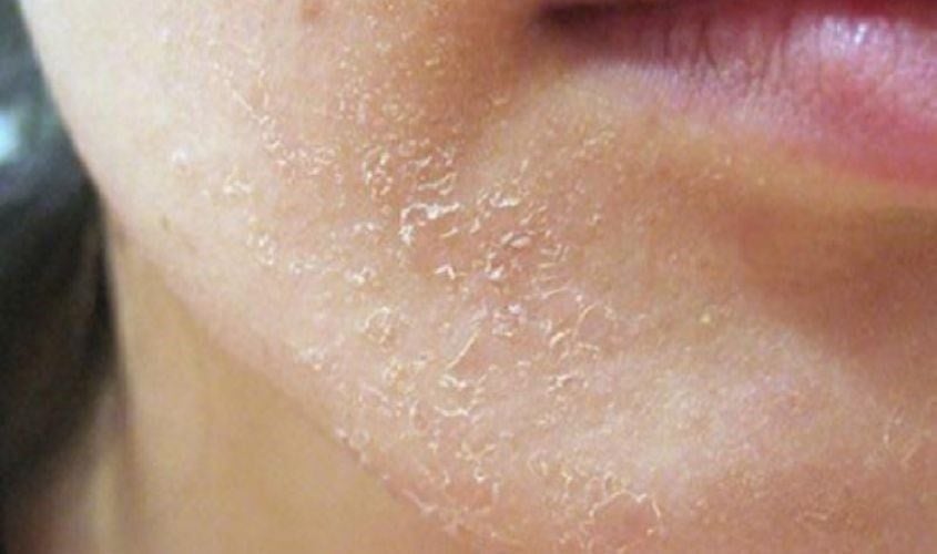 Retinol cho người mới bắt đầu