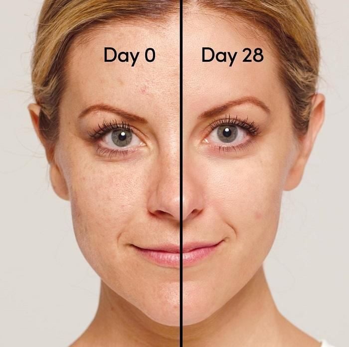 Cách sử dụng Retinol cho người mới bắt đầu