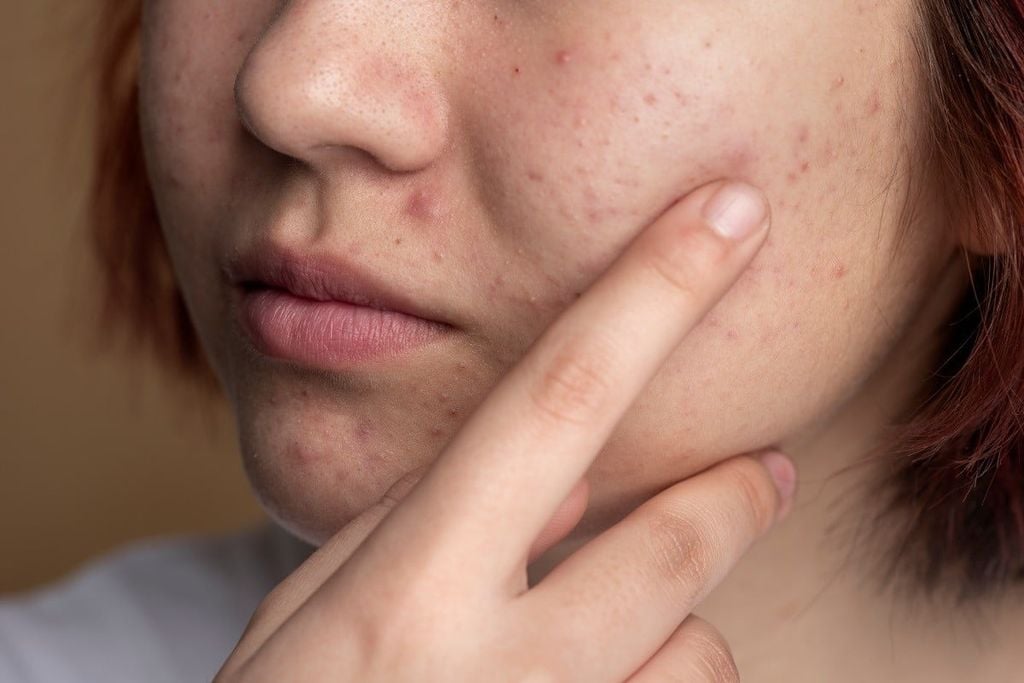 Cách sử dụng Retinol cho người mới bắt đầu