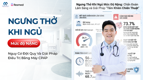 Ngưng Thở Khi Ngủ Mức Độ Nặng: Nguy Cơ Đột Quỵ Và Giải Pháp Điều Trị Bằng Máy CPAP