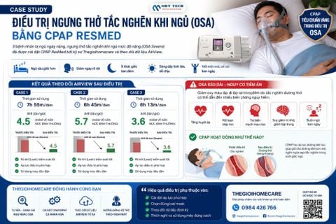Ngủ Ngáy To Và Nguy Cơ Ngưng Thở Khi Ngủ: Đừng Chủ Quan Với 