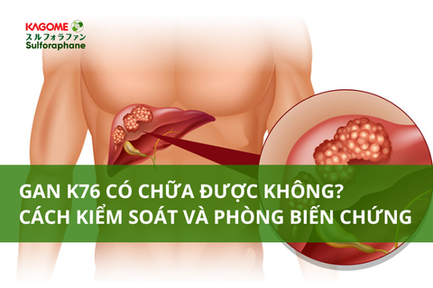 Gan K76 có chữa được không? Cách kiểm soát và phòng biến chứng