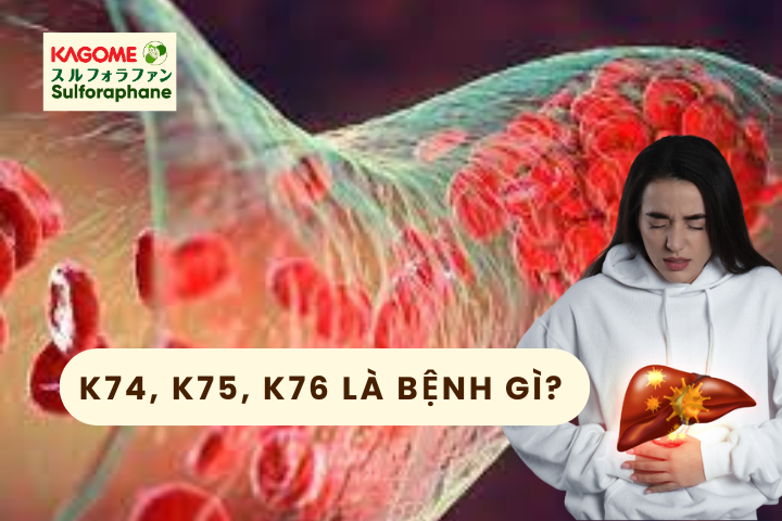 K74, K75, K76 là bệnh gì? Giải mã mã bệnh gan theo ICD-10 dễ hiểu