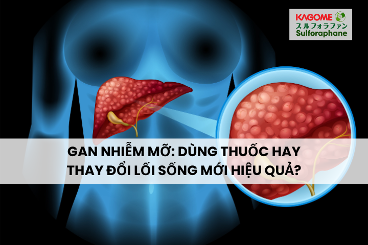 Gan nhiễm mỡ: Dùng thuốc hay thay đổi lối sống mới hiệu quả?