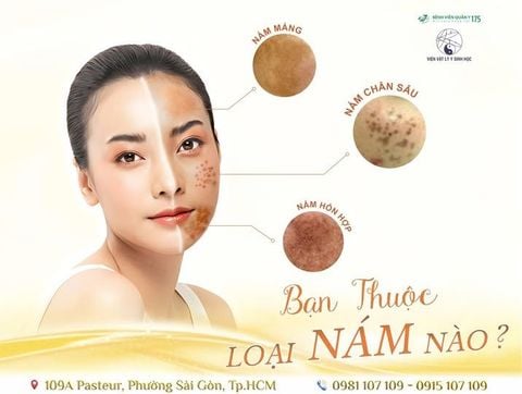 BẠN THUỘC LOẠI 