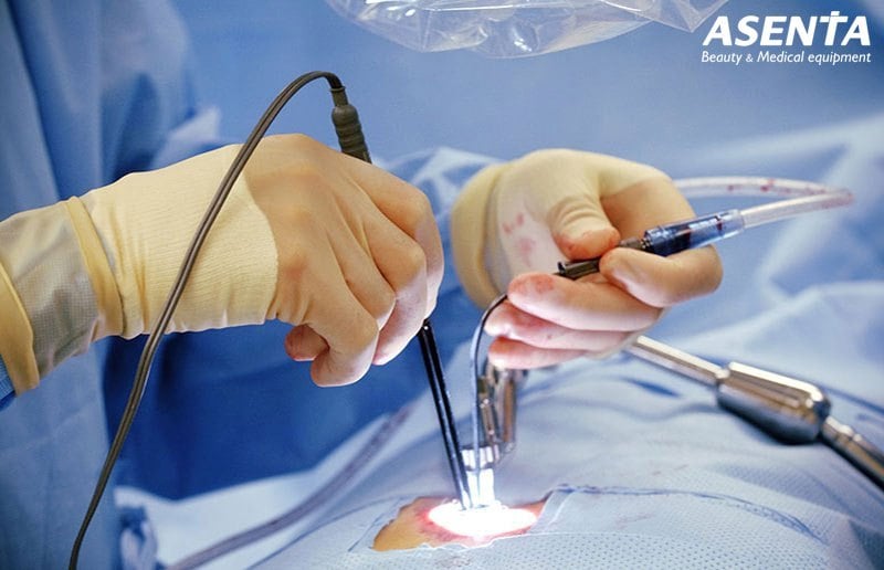 Dao mổ điện cao tần: Nguyên lý, Ứng dụng  và cách Chọn Thiết Bị