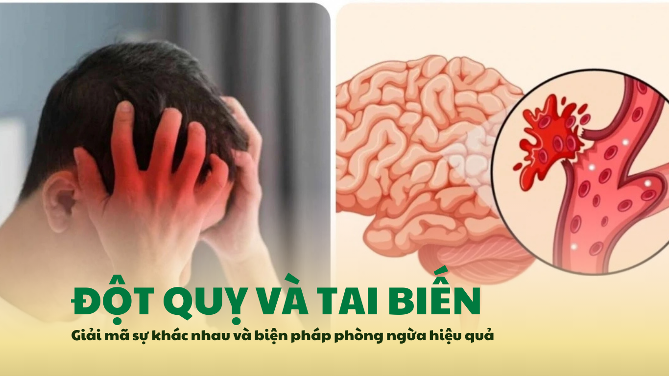 Đột quỵ và tai biến: Giải mã sự khác nhau và biện pháp phòng ngừa hiệu quả