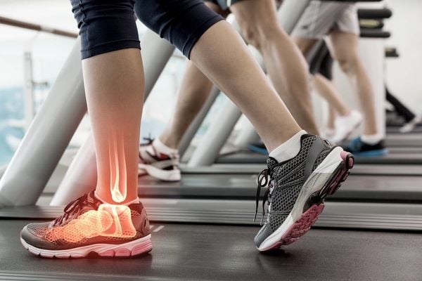 Đau cổ chân khi chạy bộ