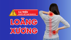 Loãng xương và gãy xương sau 40 tuổi: Nguy cơ âm thầm nhưng có thể phòng ngừa sớm