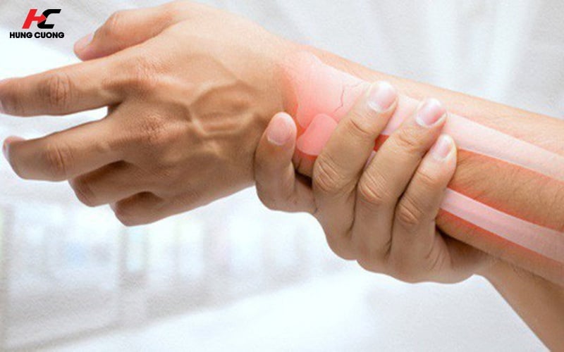 Loãng xương khiến cho người bệnh dễ bị gãy xương sau những chấn thương dù nhẹ