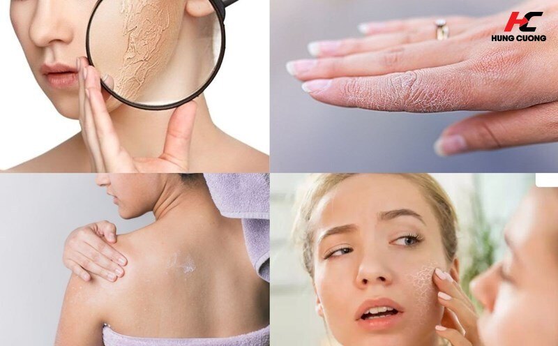 Khi cơ thể phát ra tín hiệu 