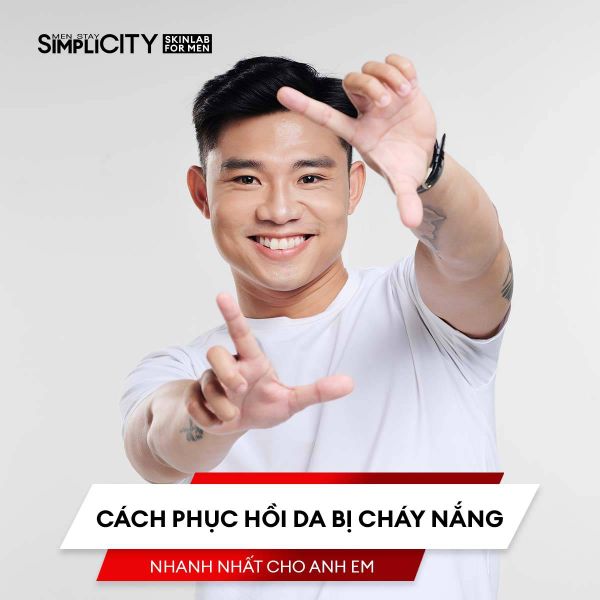 Cách phục hồi da bị cháy nắng nhanh nhất cho anh em
