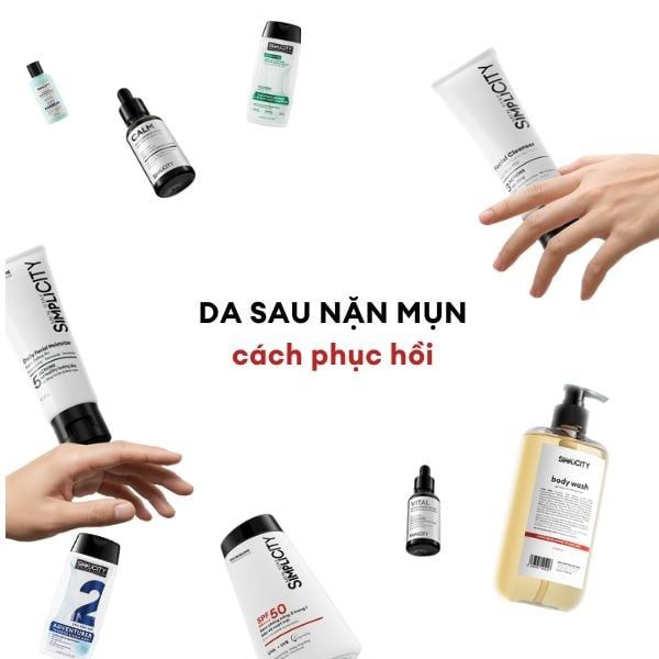 Cách phục hồi da sau nặn mụn để lại vết thâm, đỏ rát