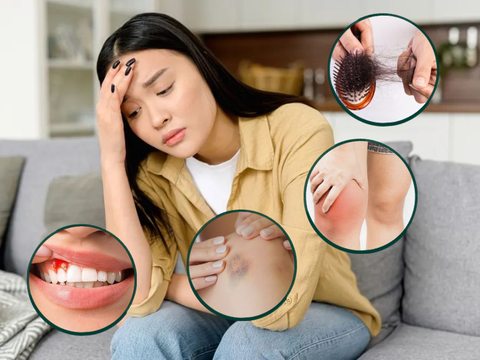 +9 dấu hiệu thiếu Vitamin C và giải pháp bổ sung hiệu quả tại nhà