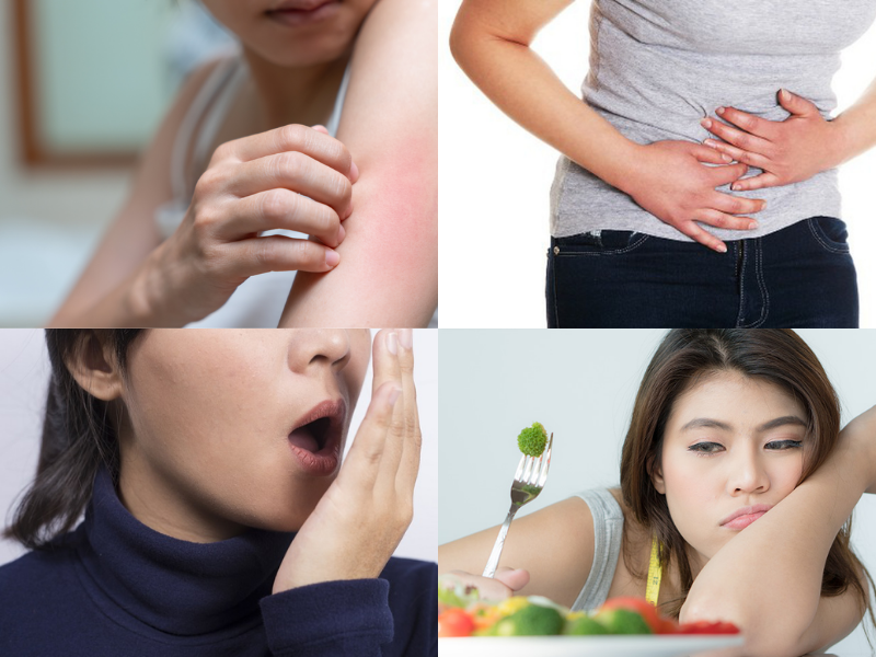 Những thay đổi trên da và cơ thể có thể là dấu hiệu cảnh báo chức năng gan suy giảm