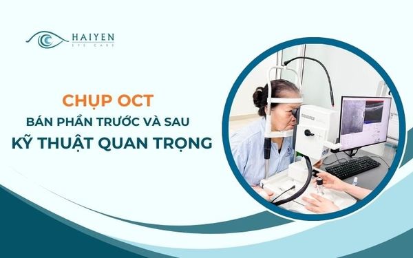 Chụp OCT Bán Phần Trước Và Sau, Đánh Giá Giác Mạc – Võng Mạc