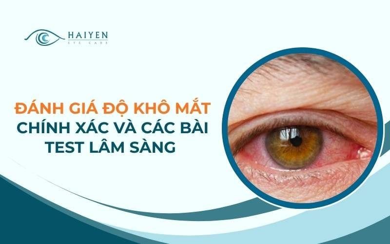 Đánh Giá Độ Khô Mắt Chính Xác Và Các Bài Test Lâm Sàng