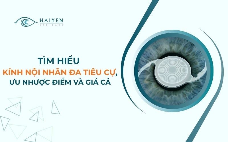 Tìm Hiểu Kính Nội Nhãn Đa Tiêu Cự, Ưu Nhược Điểm Và Giá Cả