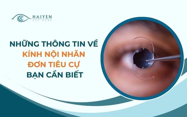 Những Thông Tin Về Kính Nội Nhãn Đơn Tiêu Cự Bạn Cần Biết