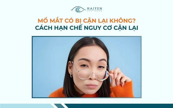 Mổ mắt có bị cận lại không? Dấu hiệu và cách hạn chế tái cận