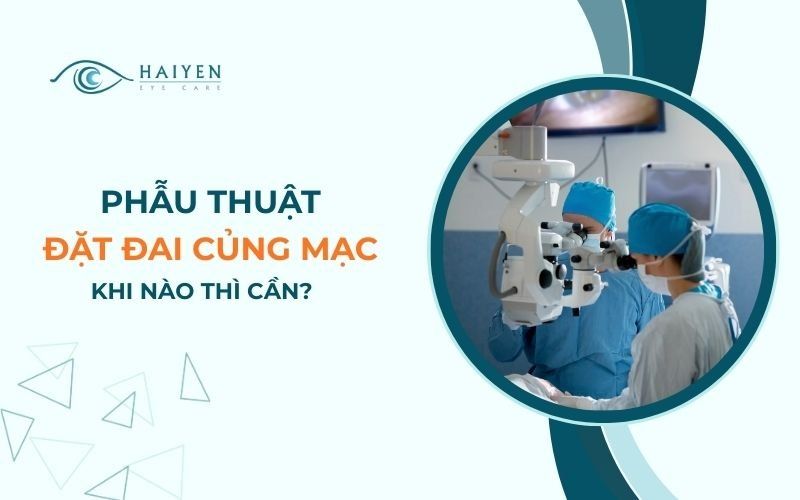 Phẫu Thuật Đặt Đai Củng Mạc Trong Điều Trị Bong Võng Mạc