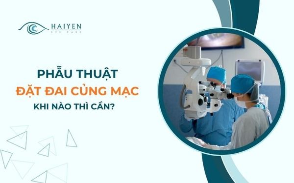 Phẫu Thuật Đặt Đai Củng Mạc Trong Điều Trị Bong Võng Mạc