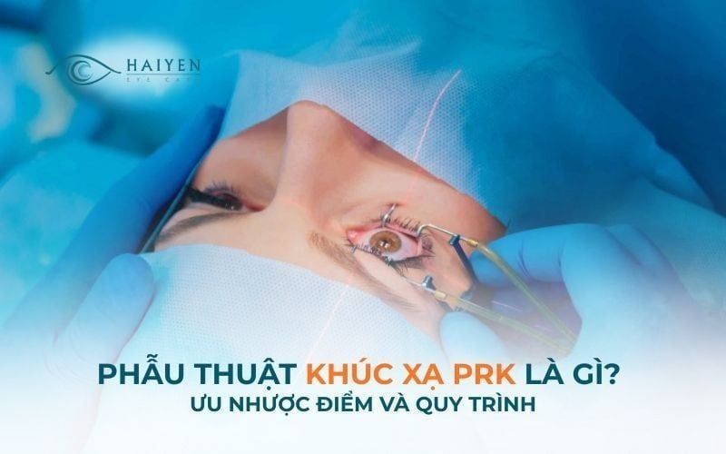 Phẫu Thuật Khúc Xạ PRK Là Gì? Ưu Nhược Điểm Và Quy Trình