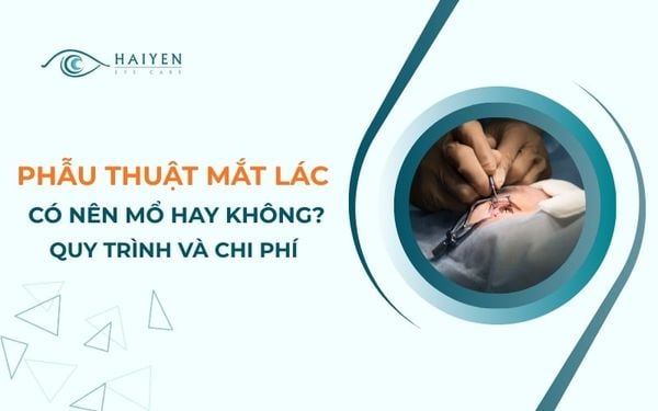 Phẫu Thuật Mắt Lác (Lé): Quy Trình, Chi Phí Và Hướng Dẫn Chăm Sóc Sau Mổ