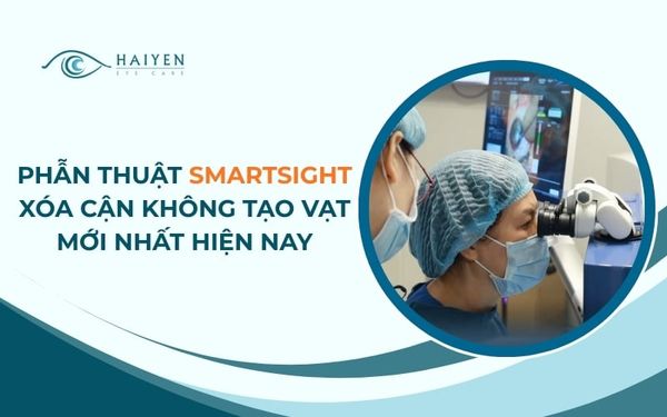 Phẫu Thuật Smartsight Xóa Cận Không Tạo Vạt Mới Nhất Hiện Nay