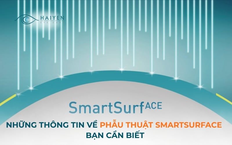 Những Thông Tin Về Phẫu Thuật Smartsurface Bạn Cần Biết