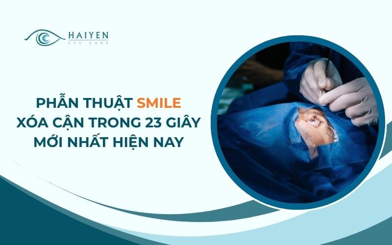 Phẫu thuật Smile - Mổ Cận Chỉ Với 23 Giây