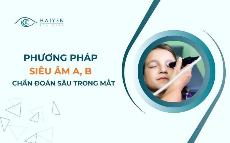 Siêu Âm Mắt - Chẩn Đoán Nội Nhãn Và Đánh Giá Bệnh Lý Võng Mạc