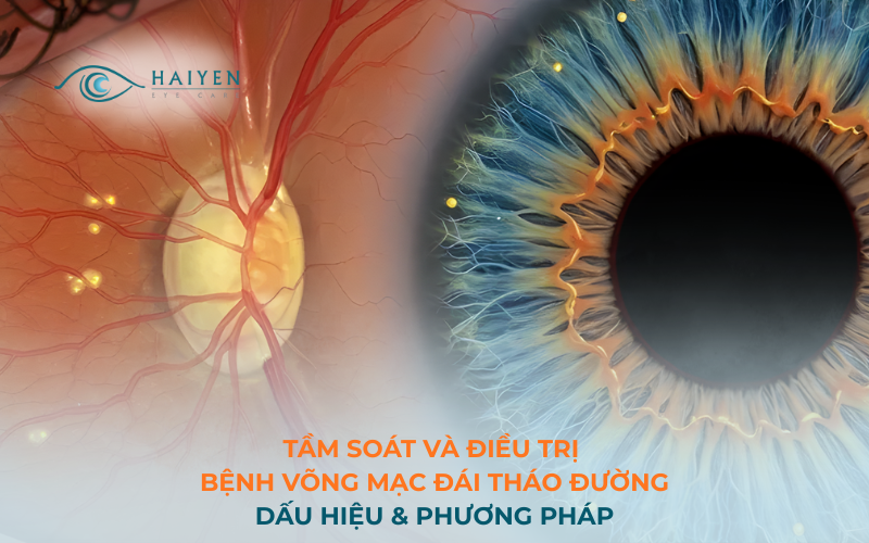 Tầm Soát Và Điều Trị Bệnh Võng Mạc Đái Tháo Đường