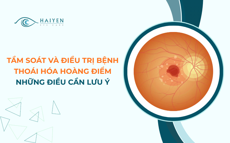 Tầm Soát Và Điều Trị Bệnh Thoái Hóa Hoàng Điểm