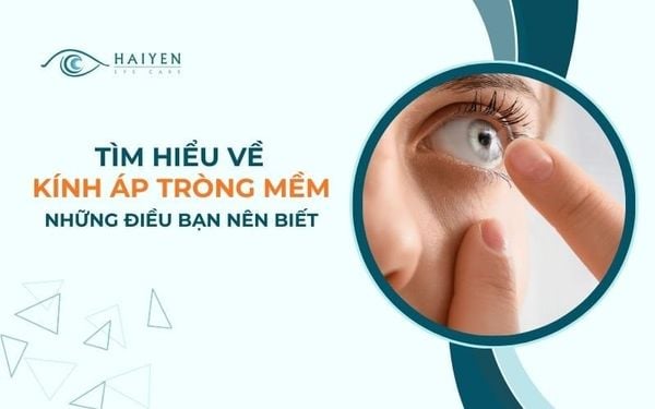 Kính Áp Tròng Mềm: Ưu Nhược Điểm Và Hướng Dẫn Sử Dụng Đúng
