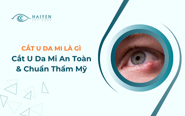 Cắt U Da Mi An Toàn & Chuẩn Thẩm Mỹ Tại Hải Yến Eye Care