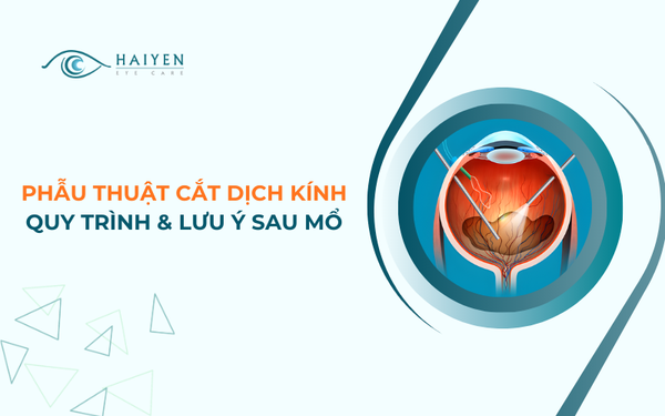 Phẫu Thuật Cắt Dịch Kính: Chỉ Định, Quy Trình & Hồi Phục