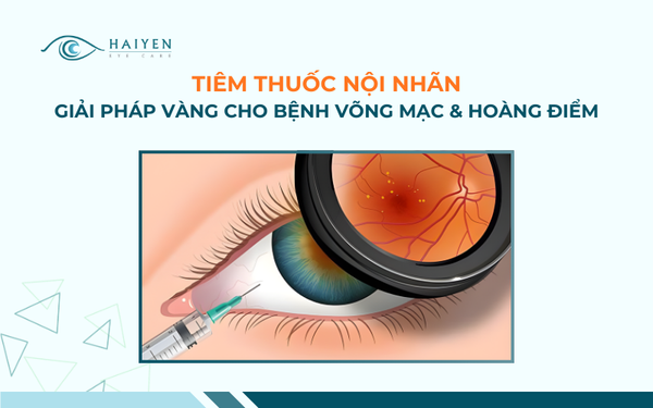 Tiêm Thuốc Nội Nhãn: Chỉ Định, Quy Trình & Hiệu Quả