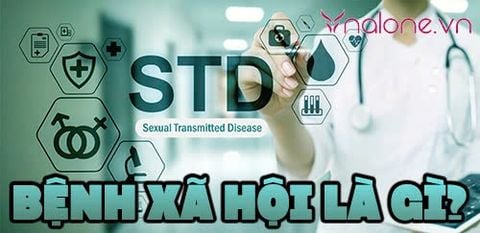 Bệnh xã hội là gì? Nhận biết dấu hiệu sớm và cách phòng tránh hiệu quả