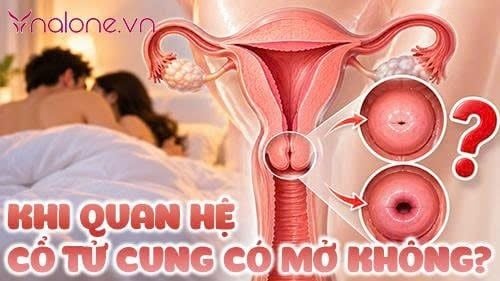 Khi quan hệ cổ tử cung có mở không? Giải đáp từ chuyên gia