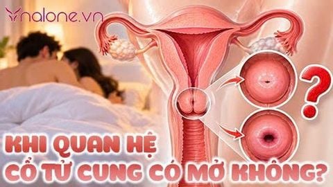 Khi quan hệ cổ tử cung có mở không? Giải đáp từ chuyên gia