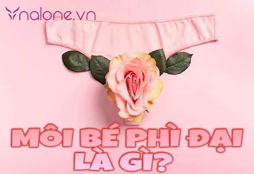 Môi bé phì đại là gì? Nguyên nhân và cách khắc phục hiệu quả
