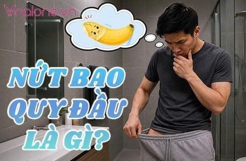 Nứt bao quy đầu là gì? Nguyên nhân và cách xử lý an toàn