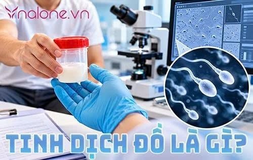 Tinh dịch đồ là gì? Quy trình xét nghiệm và các chỉ số chuẩn